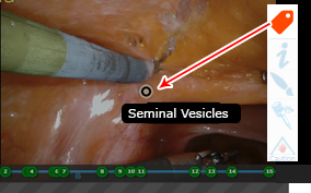 lapGuru Anatomy Tags