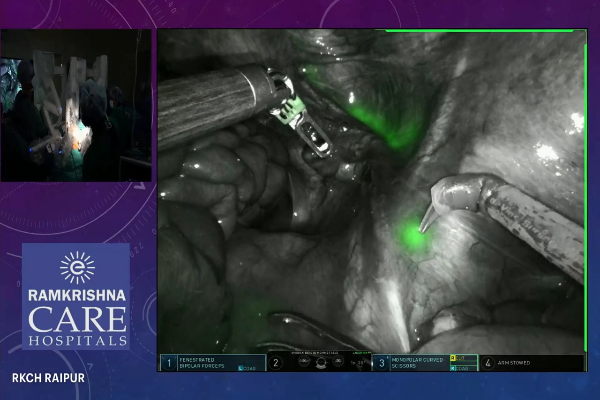  CA Cervix - Robotic Hysterectomy