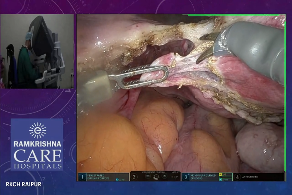 Total Robotic Hysterectomy